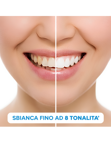 Kit Sbiancamento Denti in 20 Minuti con Penna...