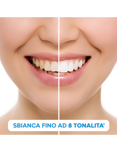 Kit Sbiancamento Denti in 20 Minuti con Penna Sbiancante e Gel Tecnologia LED