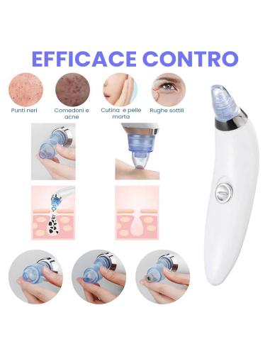 Aspiratore SUCTION pulitore facciale 345636...