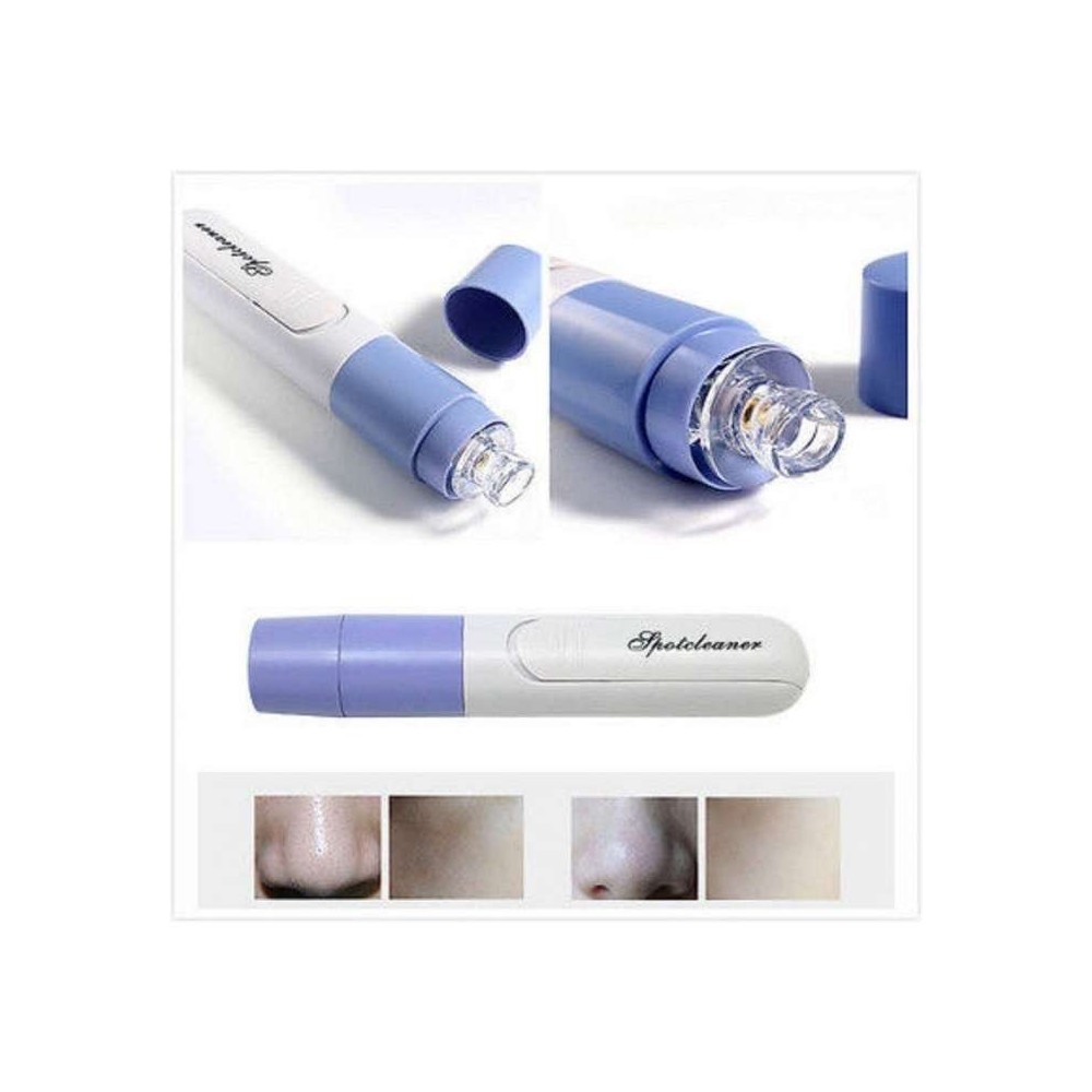 Aspiratore pulitore facciale 178521 per pulire...