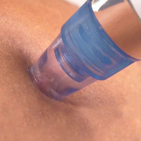 Aspiratore SUCTION pulitore facciale 345636 pulizia pori punti neri e impurità