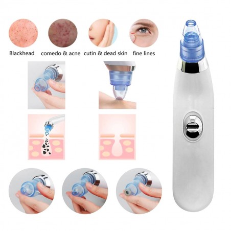 Aspiratore SUCTION pulitore facciale 345636 pulizia pori punti neri e impurità