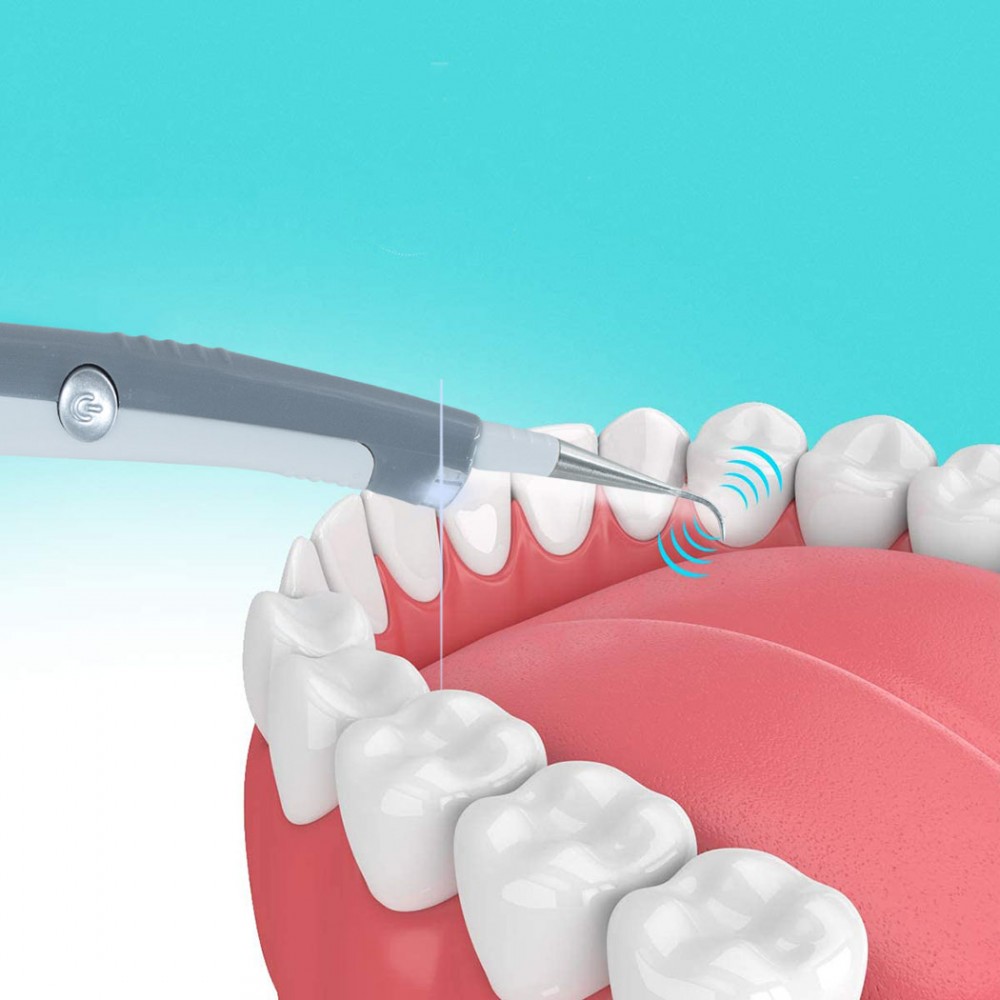 Sonic PLC Sistema per la pulizia e igiene...