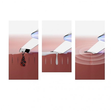 Scrubber per Pulizia del Viso 265639 Rimuove Punti Neri e Massaggiatore Facciale